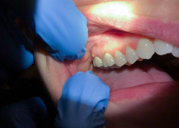 Best Emergency Cosmetic Dentistry (e.g., broken veneers) in Dayton, VA